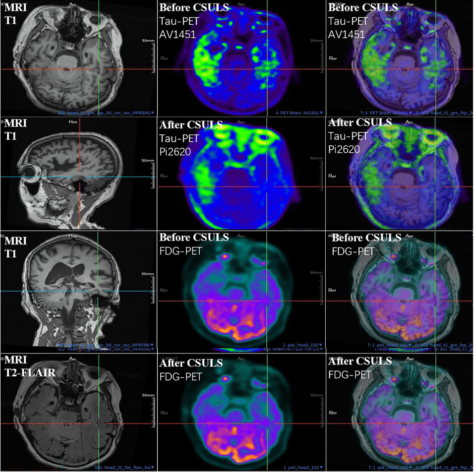 300多家医院抢着做的手术，为何突被禁？